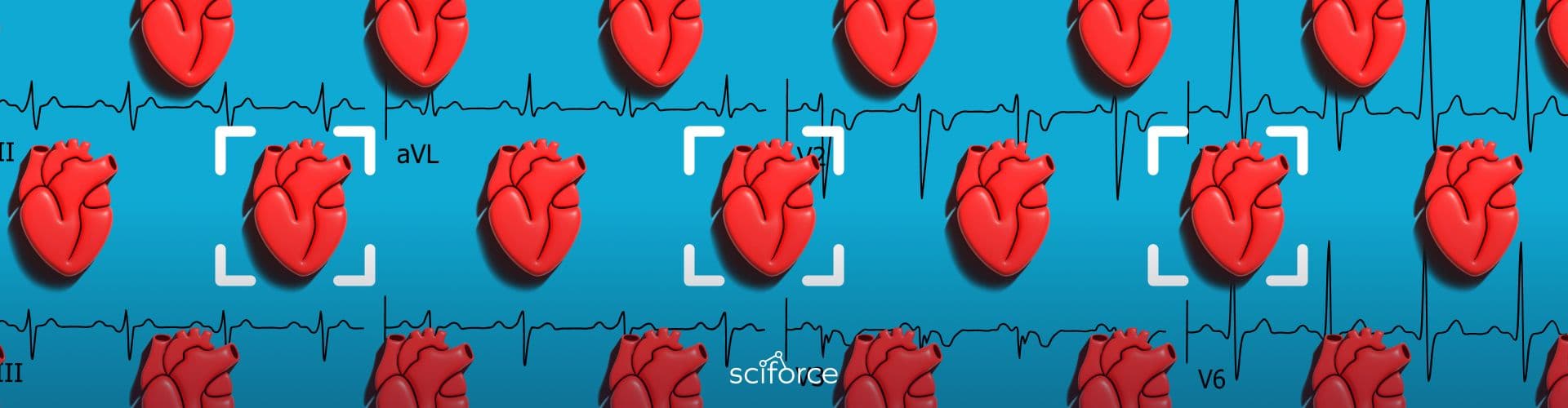 ML-Driven ECG Interpretation cover