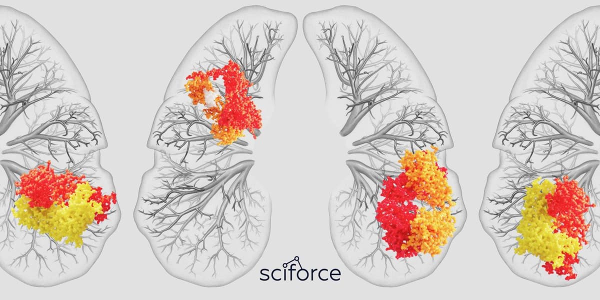 Automated Lung Pathology Detection cover